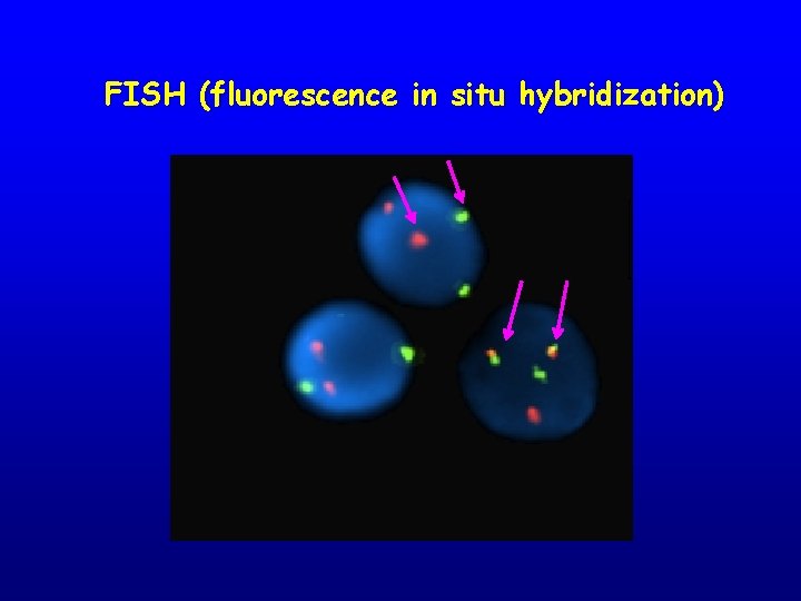 FISH (fluorescence in situ hybridization) 