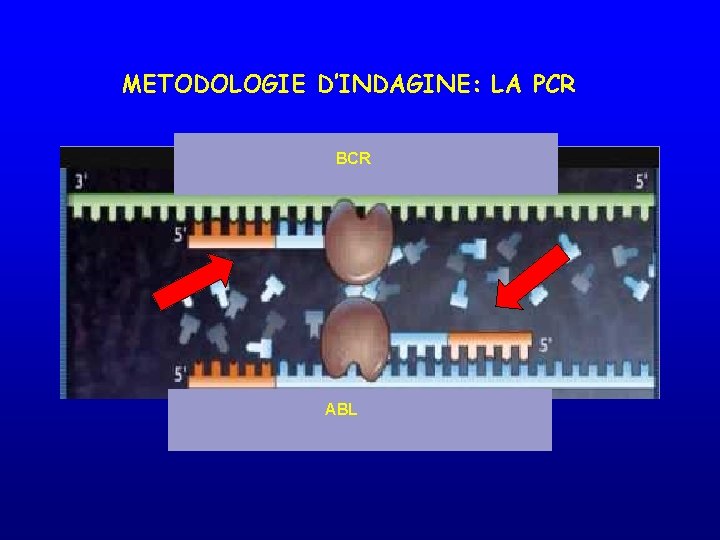 METODOLOGIE D’INDAGINE: LA PCR BCR ABL 