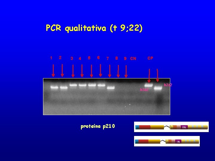 PCR qualitativa (t 9; 22) 1 2 3 4 5 6 7 8 9