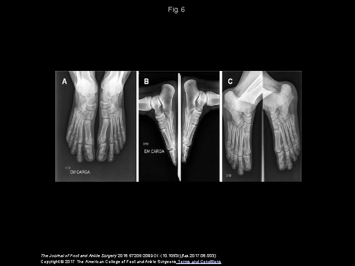 Fig.  6 The Journal of Foot and Ankle Surgery 2018 57205 -209 DOI: (10.