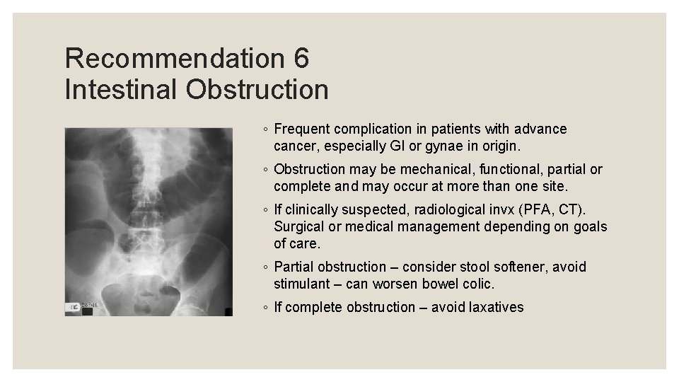 Recommendation 6 Intestinal Obstruction ◦ Frequent complication in patients with advance cancer, especially GI