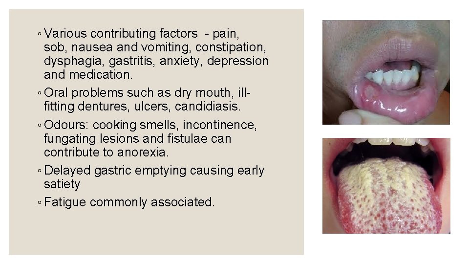 ◦ Various contributing factors - pain, sob, nausea and vomiting, constipation, dysphagia, gastritis, anxiety,