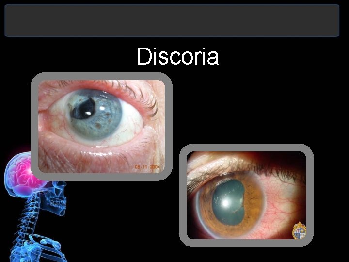 Discoria 