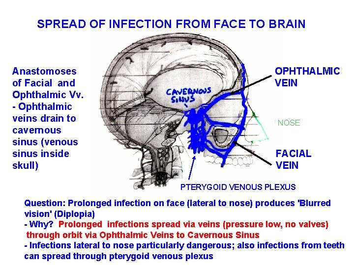 SPREAD OF INFECTION FROM FACE TO BRAIN Anastomoses of Facial and Ophthalmic Vv. -