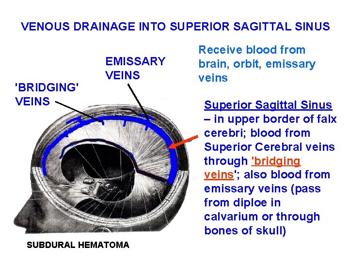 VENOUS DRAINAGE INTO SUPERIOR SAGITTAL SINUS 'BRIDGING' VEINS EMISSARY VEINS SUBDURAL HEMATOMA Receive blood