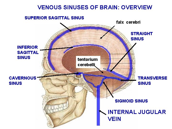 VENOUS SINUSES OF BRAIN: OVERVIEW SUPERIOR SAGITTAL SINUS falx cerebri STRAIGHT SINUS INFERIOR SAGITTAL