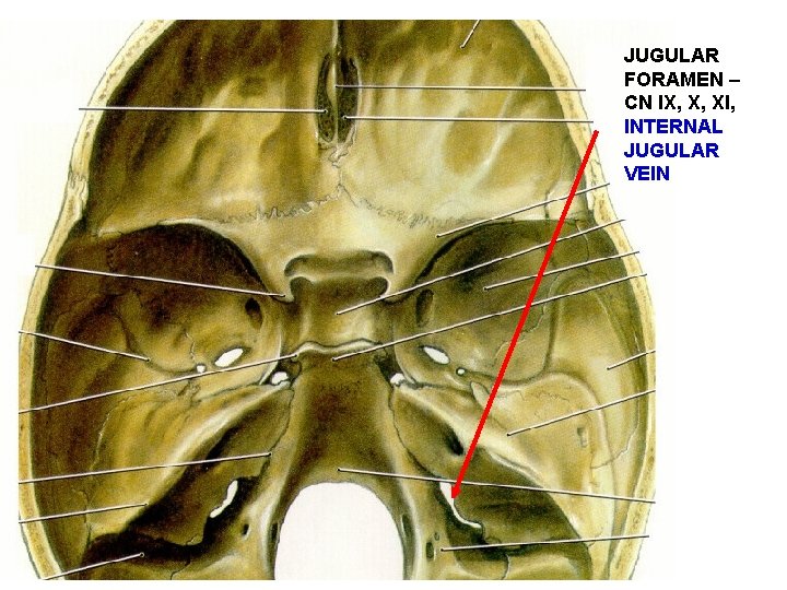 JUGULAR FORAMEN – CN IX, X, XI, INTERNAL JUGULAR VEIN 