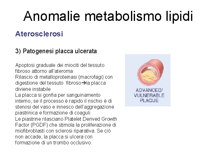 Anomalie metabolismo lipidi Aterosclerosi 3) Patogenesi placca ulcerata Apoptosi graduale dei miociti del tessuto