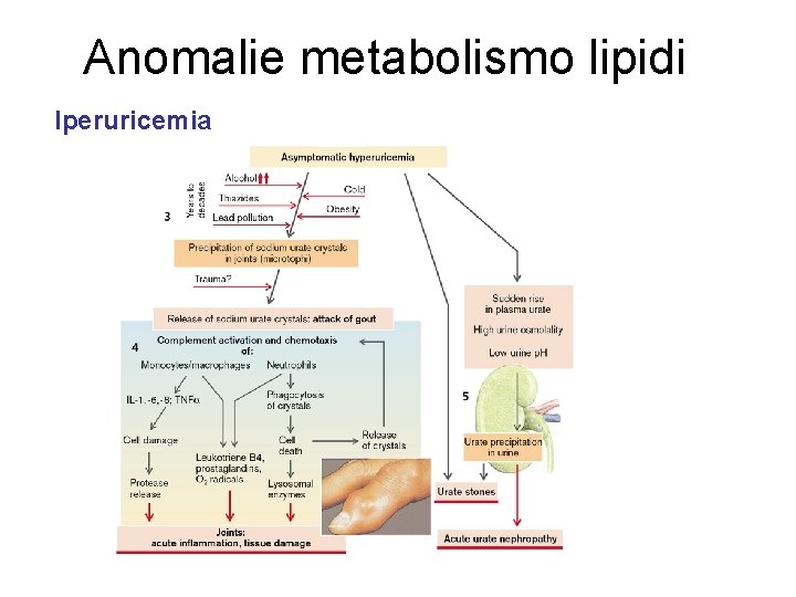 Anomalie metabolismo lipidi Iperuricemia 