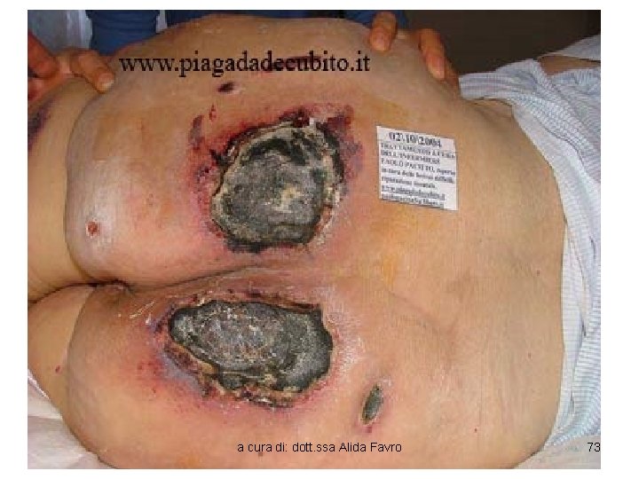 a cura di: dott. ssa Alida Favro 73 