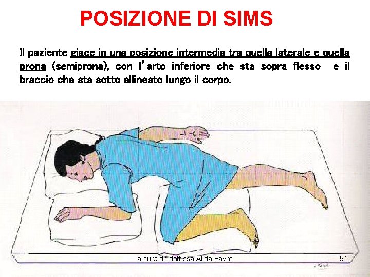 POSIZIONE DI SIMS Il paziente giace in una posizione intermedia tra quella laterale e