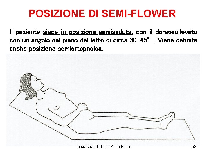 POSIZIONE DI SEMI-FLOWER Il paziente giace in posizione semiseduta, con il dorsosollevato con un