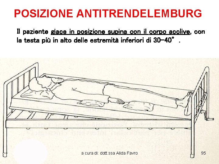 POSIZIONE ANTITRENDELEMBURG Il paziente giace in posizione supina con il corpo acclive, con la