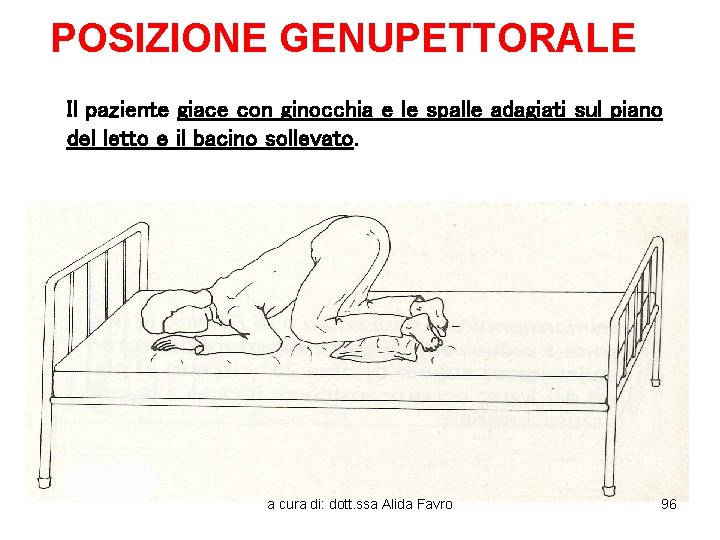 POSIZIONE GENUPETTORALE Il paziente giace con ginocchia e le spalle adagiati sul piano del
