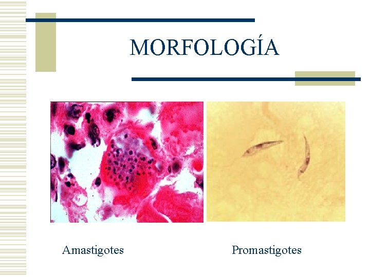 MORFOLOGÍA Amastigotes Promastigotes MORFOLOGÍA Amastigotes Promastigotes