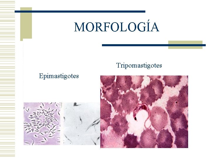 MORFOLOGÍA Tripomastigotes Epimastigotes MORFOLOGÍA Tripomastigotes Epimastigotes