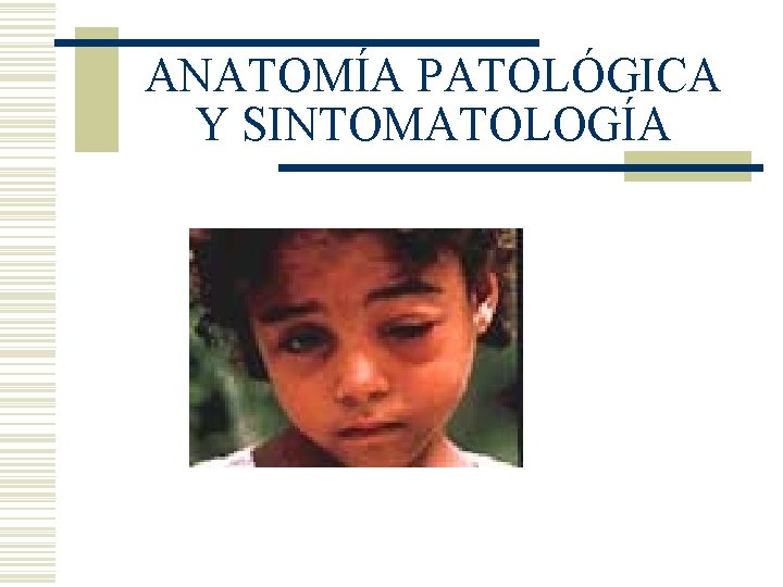 ANATOMÍA PATOLÓGICA Y SINTOMATOLOGÍA ANATOMÍA PATOLÓGICA Y SINTOMATOLOGÍA