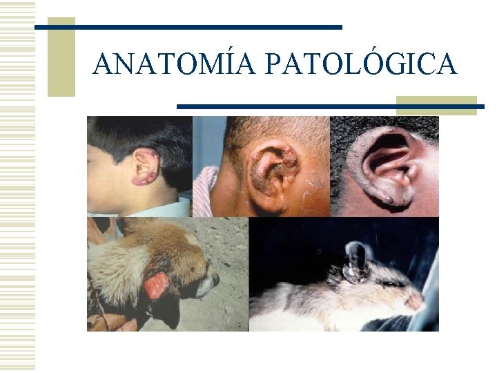 ANATOMÍA PATOLÓGICA ANATOMÍA PATOLÓGICA