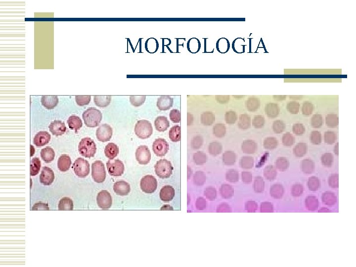 MORFOLOGÍA MORFOLOGÍA