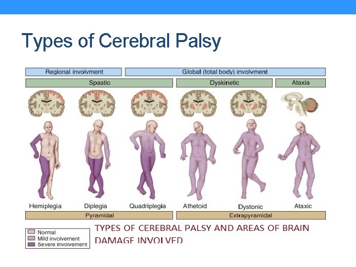 Types of Cerebral Palsy 