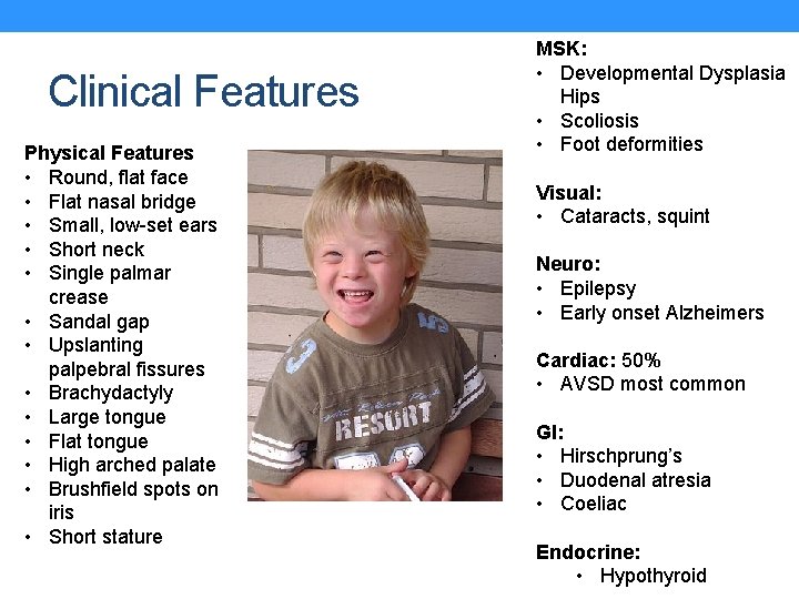 Clinical Features Physical Features • Round, flat face • Flat nasal bridge • Small,