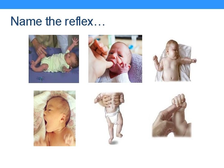 Name the reflex… 