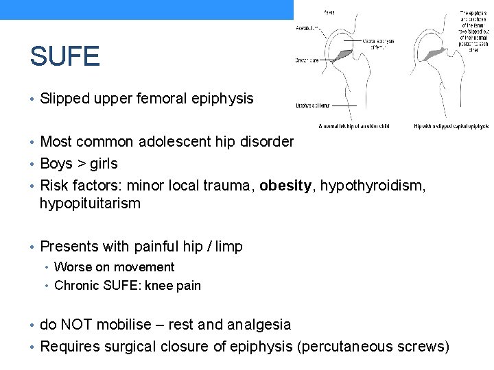 SUFE • Slipped upper femoral epiphysis • Most common adolescent hip disorder • Boys