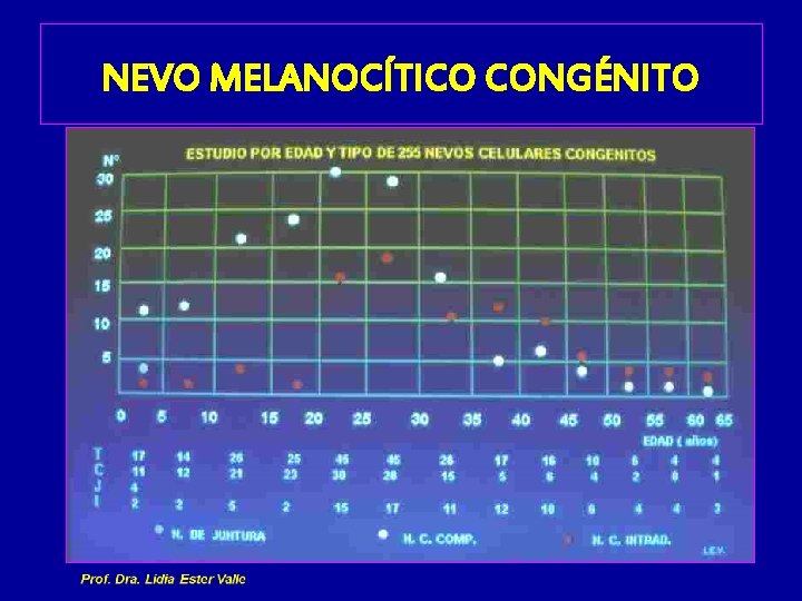 NEVO MELANOCÍTICO CONGÉNITO 