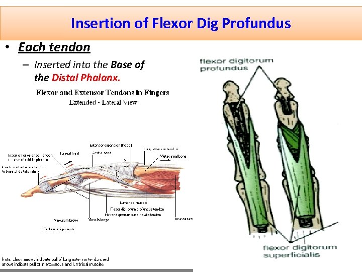 Insertion of Flexor Dig Profundus • Each tendon – Inserted into the Base of
