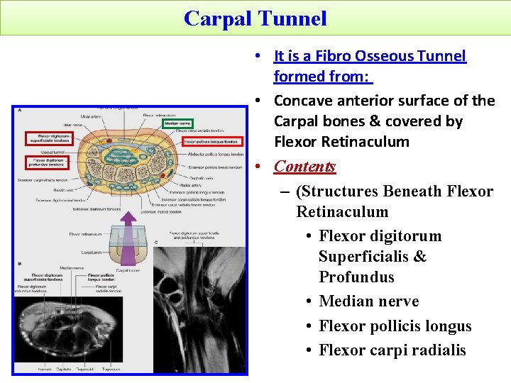 Carpal Tunnel • It is a Fibro Osseous Tunnel formed from: • Concave anterior