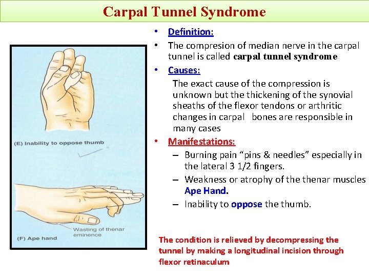 Carpal Tunnel Syndrome • Definition: • The compresion of median nerve in the carpal
