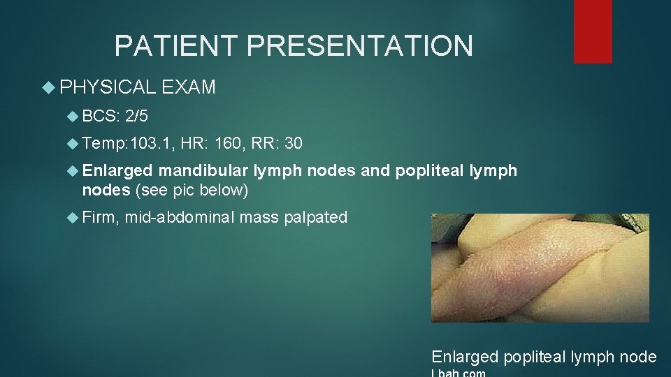 PATIENT PRESENTATION PHYSICAL BCS: EXAM 2/5 Temp: 103. 1, HR: 160, RR: 30 Enlarged PATIENT PRESENTATION PHYSICAL BCS: EXAM 2/5 Temp: 103. 1, HR: 160, RR: 30 Enlarged