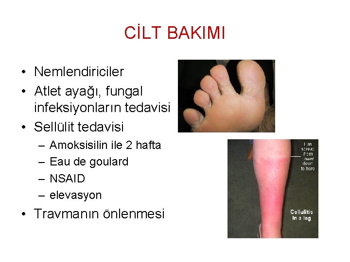 CİLT BAKIMI • Nemlendiriciler • Atlet ayağı, fungal infeksiyonların tedavisi • Sellülit tedavisi –