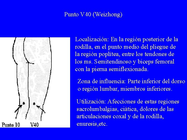 Punto V 40 (Weizhong) Localización: En la región posterior de la rodilla, en el