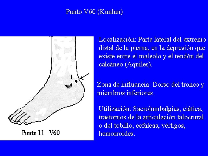 Punto V 60 (Kunlun) Localización: Parte lateral del extremo distal de la pierna, en