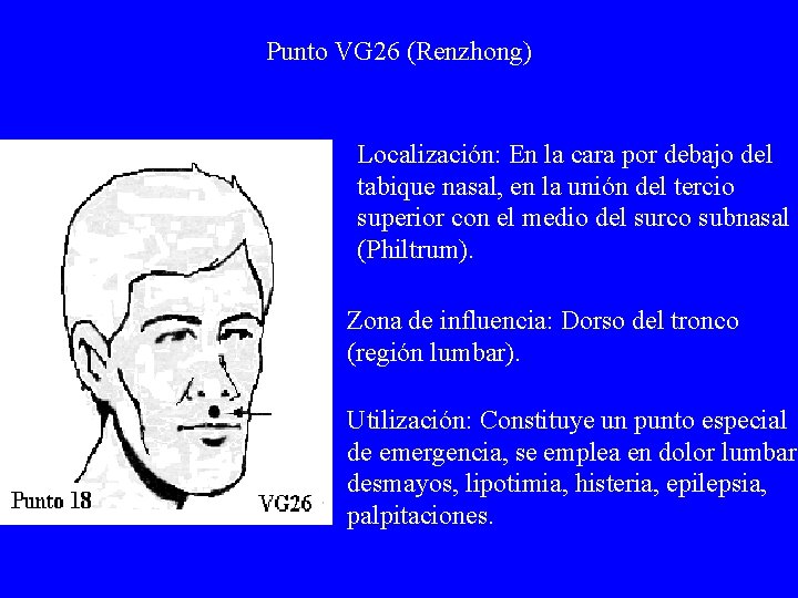 Punto VG 26 (Renzhong) Localización: En la cara por debajo del tabique nasal, en