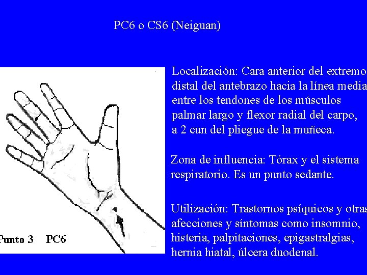 PC 6 o CS 6 (Neiguan) Localización: Cara anterior del extremo distal del antebrazo