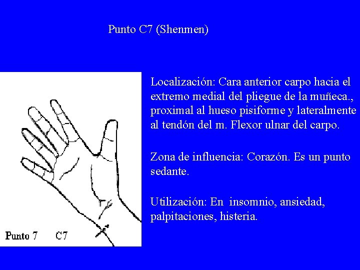 Punto C 7 (Shenmen) Localización: Cara anterior carpo hacia el extremo medial del pliegue