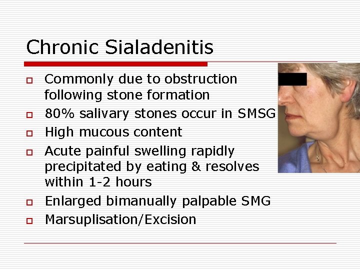 Chronic Sialadenitis o o o Commonly due to obstruction following stone formation 80% salivary