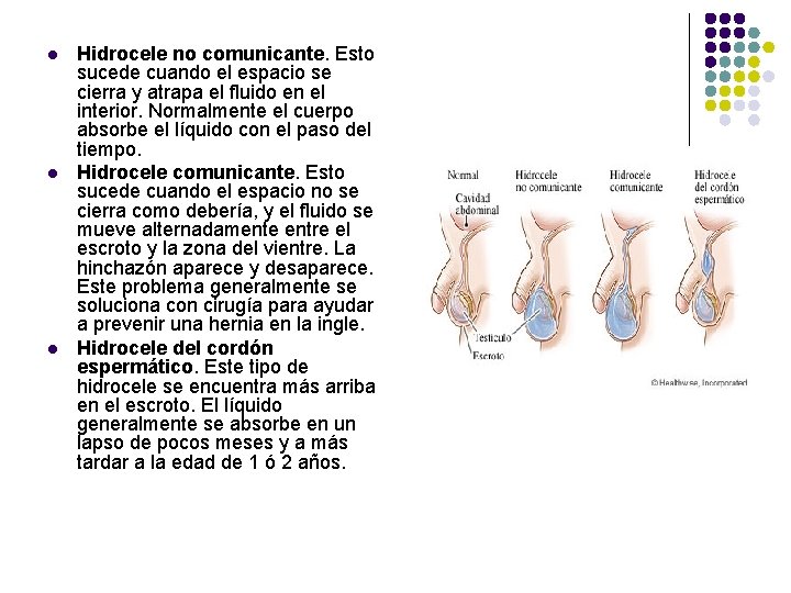 l l l Hidrocele no comunicante. Esto sucede cuando el espacio se cierra y