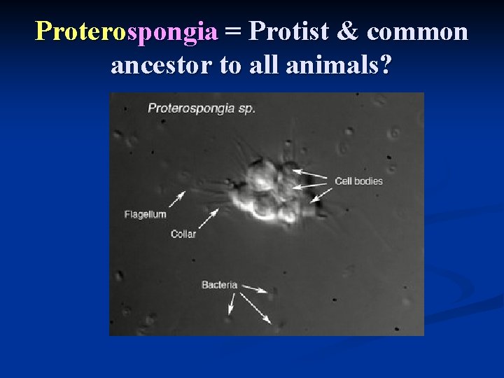 Proterospongia = Protist & common ancestor to all animals? 