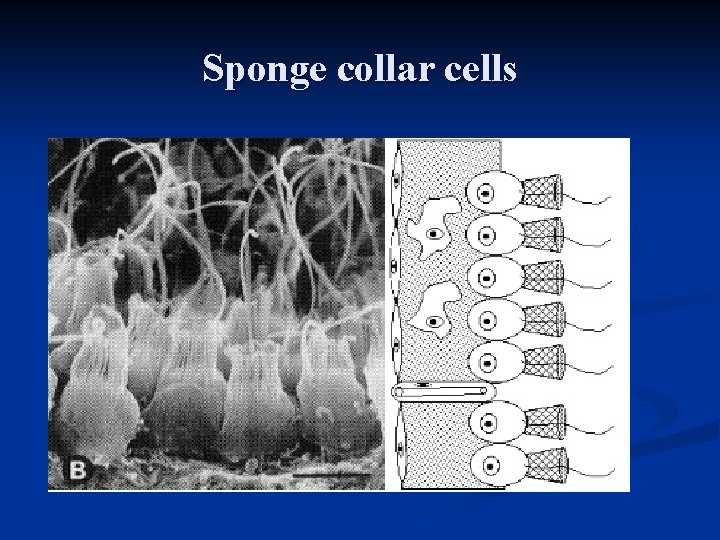 Sponge collar cells 