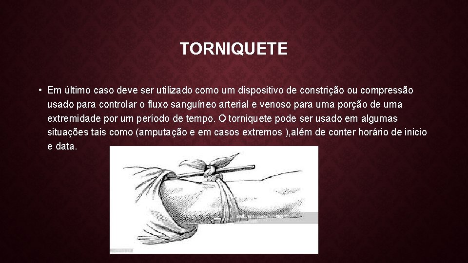 TORNIQUETE • Em último caso deve ser utilizado como um dispositivo de constrição ou