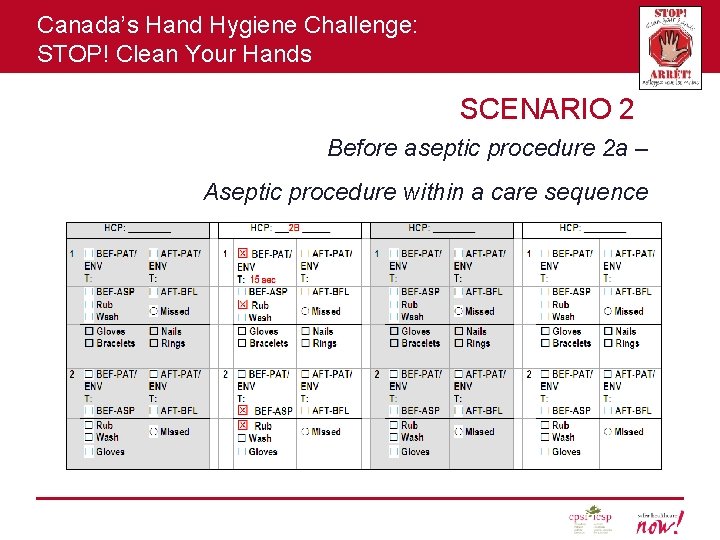 Canada’s Hand Hygiene Challenge: STOP! Clean Your Hands SCENARIO 2 Before aseptic procedure 2
