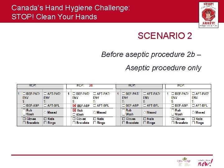 Canada’s Hand Hygiene Challenge: STOP! Clean Your Hands SCENARIO 2 Before aseptic procedure 2