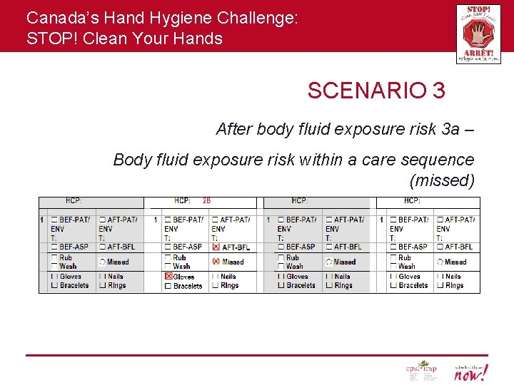 Canada’s Hand Hygiene Challenge: STOP! Clean Your Hands SCENARIO 3 After body fluid exposure