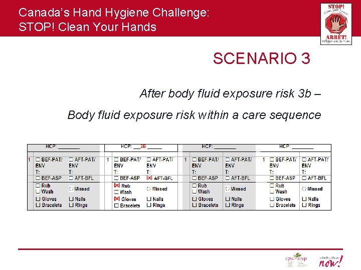 Canada’s Hand Hygiene Challenge: STOP! Clean Your Hands SCENARIO 3 After body fluid exposure