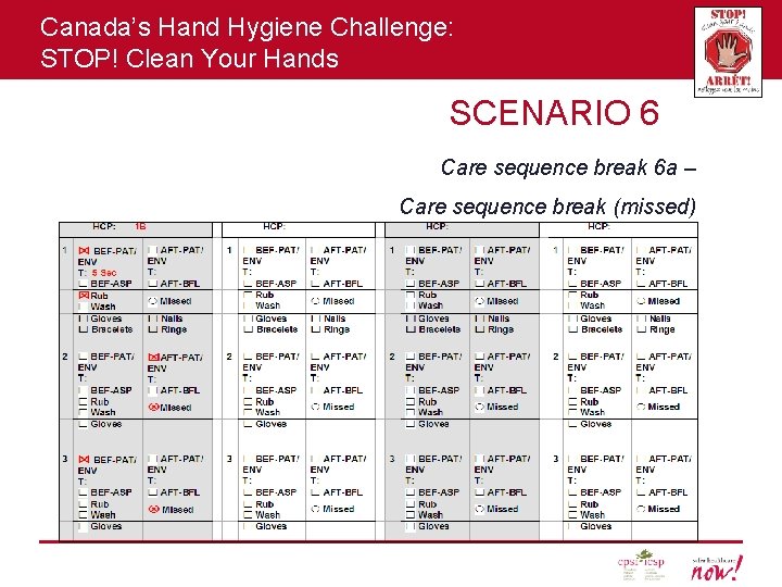 Canada’s Hand Hygiene Challenge: STOP! Clean Your Hands SCENARIO 6 Care sequence break 6