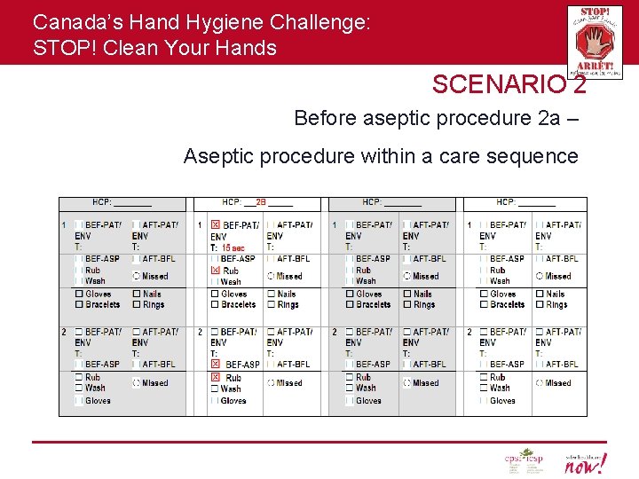 Canada’s Hand Hygiene Challenge: STOP! Clean Your Hands SCENARIO 2 Before aseptic procedure 2