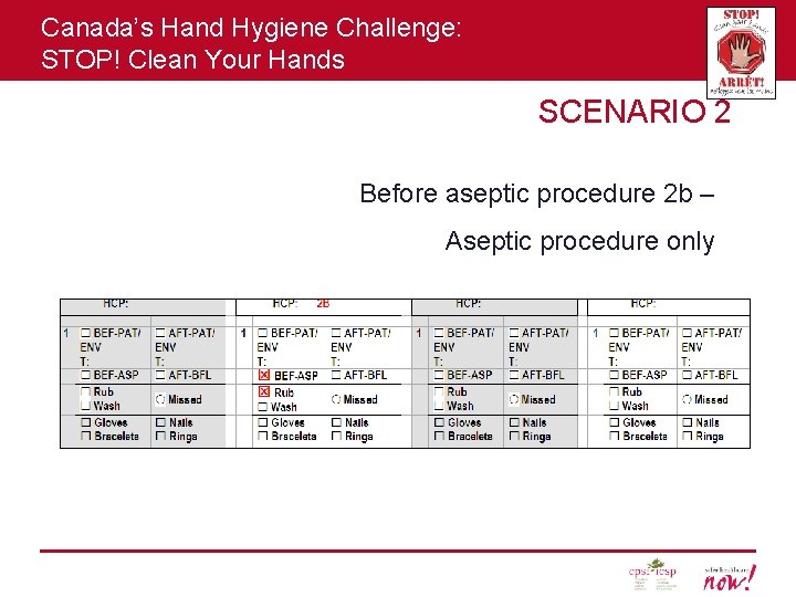 Canada’s Hand Hygiene Challenge: STOP! Clean Your Hands SCENARIO 2 Before aseptic procedure 2